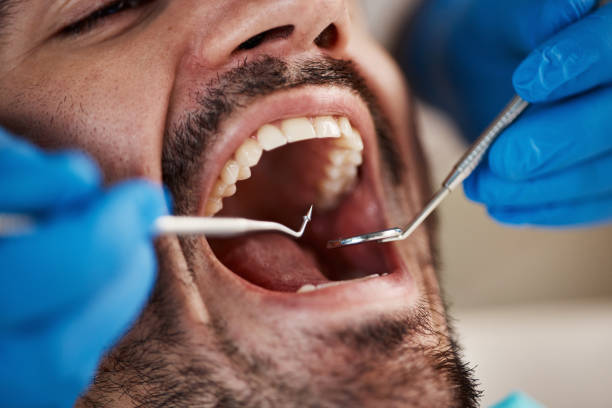 Emergency Dentist Open Today in WA